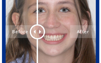 Amazing Smile Transformations